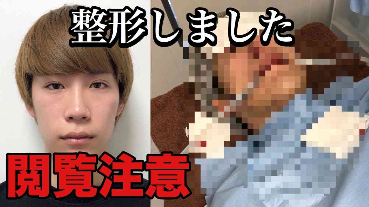 ゆうきの整形の全てを見せます。 - YouTube