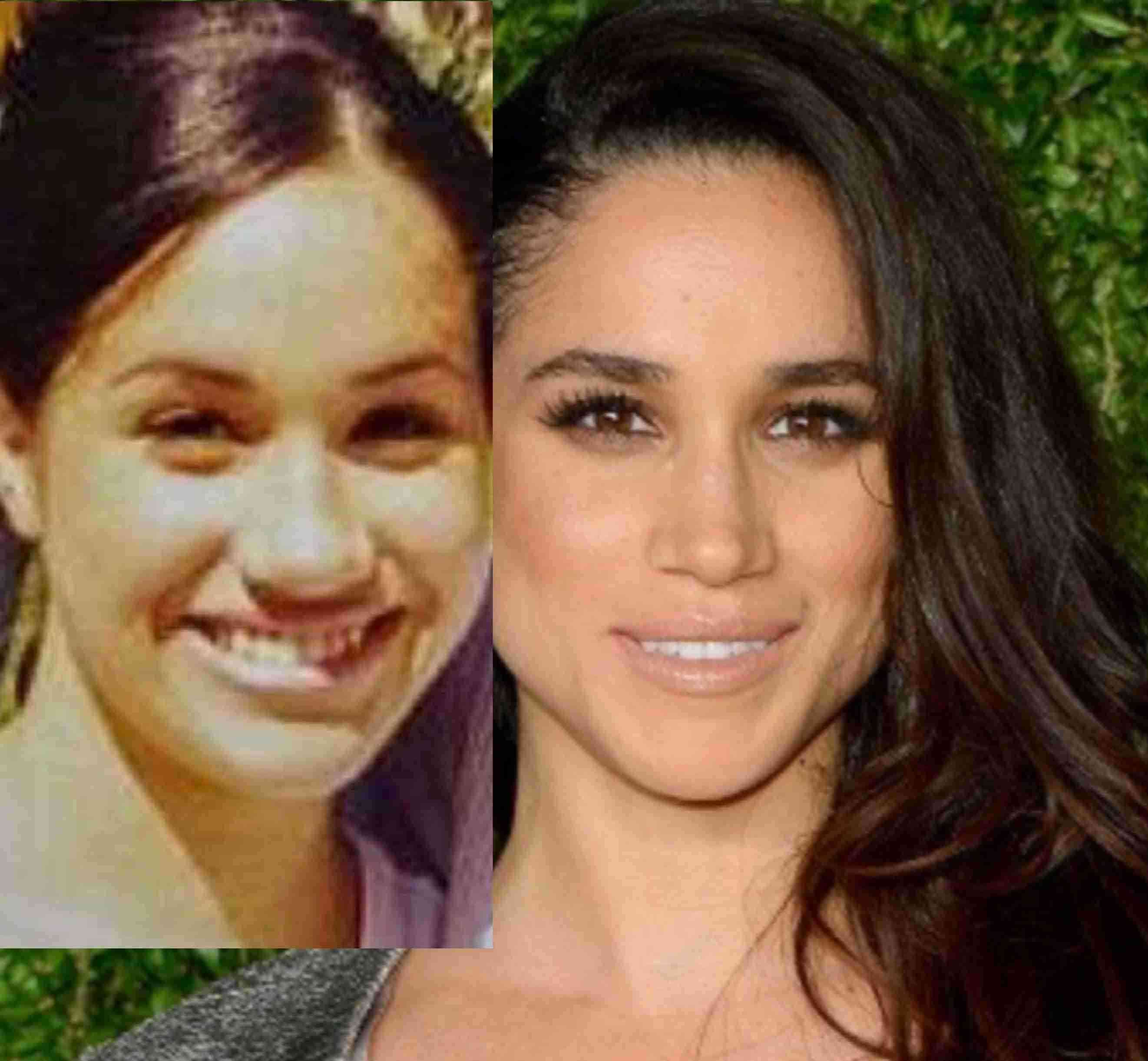 メーガン妃、ウィンブルドンテニスにサプライズ登場