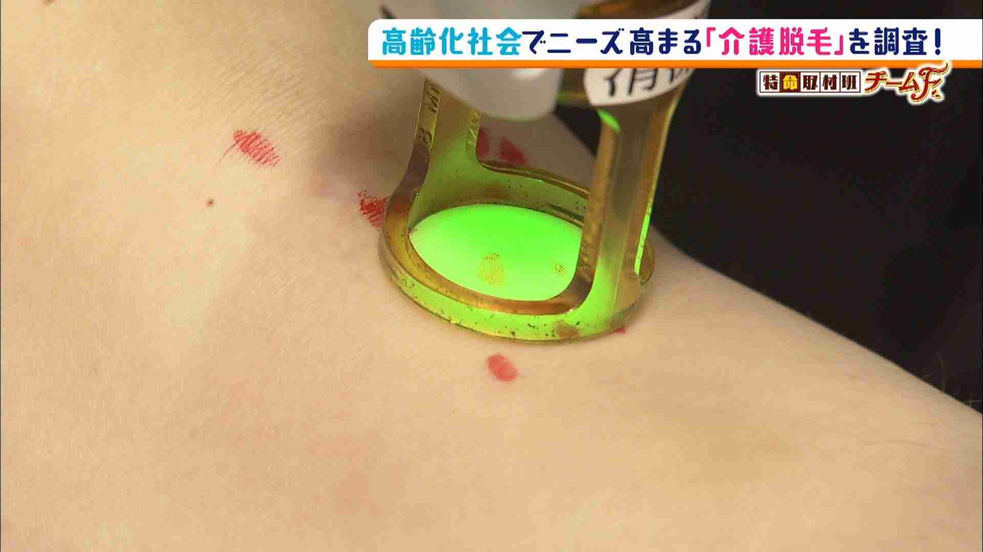 “介護される前“の世代が注目「介護脱毛」　ニーズ高まる背景は？（MBSニュース） - Yahoo!ニュース