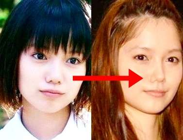 双子モデル・吉川ちえ、鼻の整形手術を報告　整形総額は700万超に