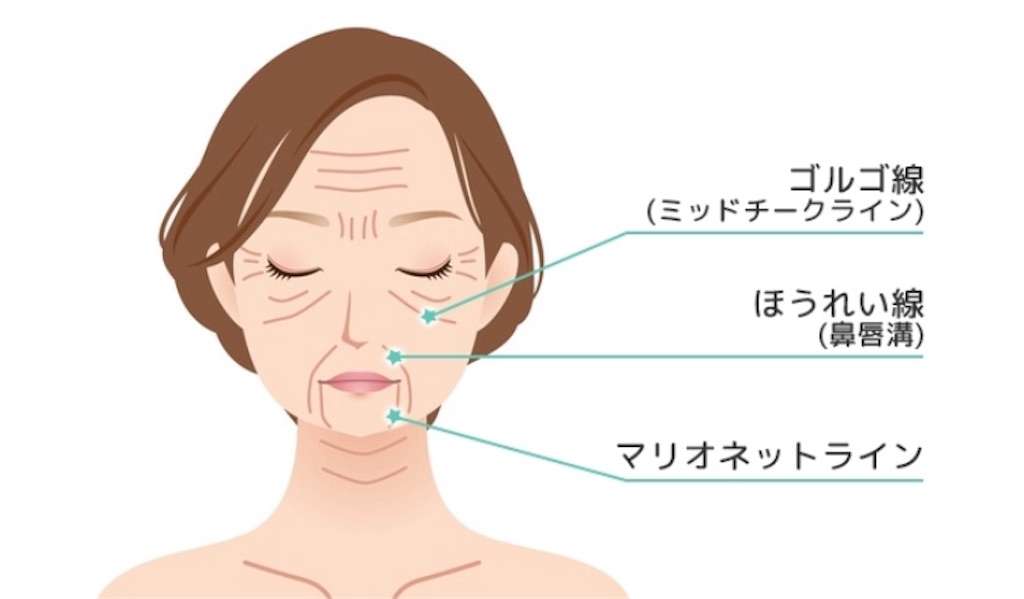 マリオネットライン【わりばし口輪筋トレーニング】たった30秒で解消♡ - 永遠の２０代