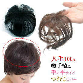 髪の毛の悩み