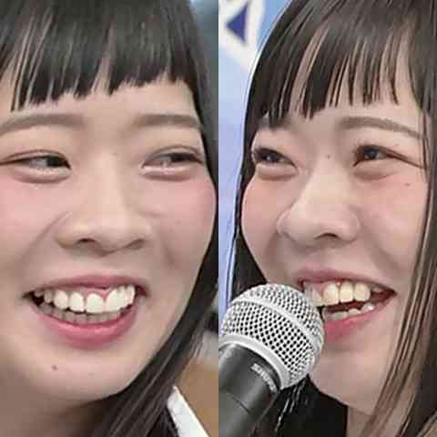 歯列矯正やり直した方