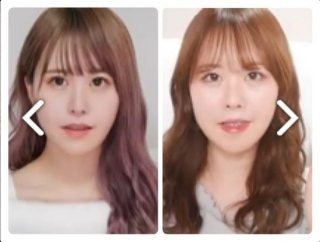 小顔整形したことある方！