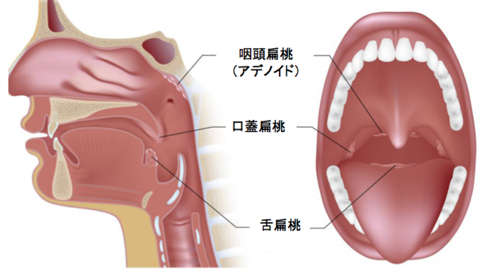 扁桃腺摘出手術をされた方