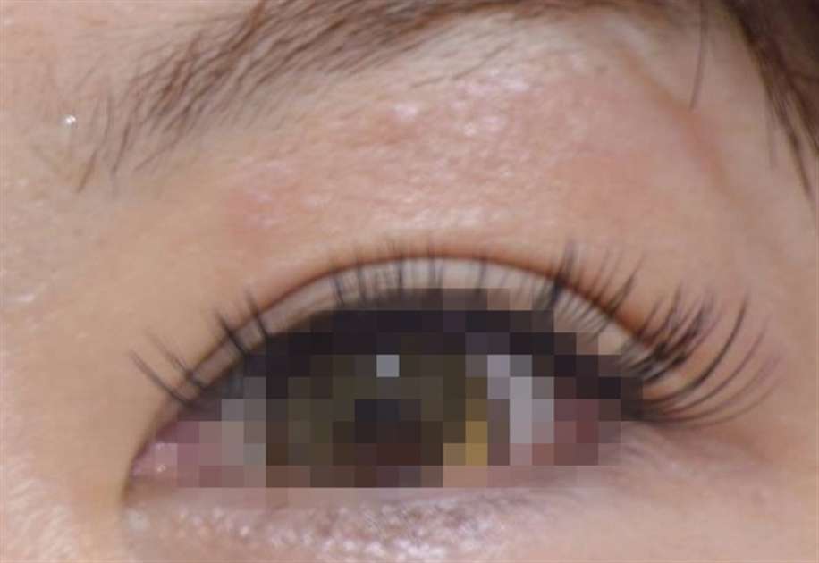 違法まつエク なぜ減らぬ　手軽に習得、指南動画も　失明、無保険…業界団体が警鐘｜【西日本新聞ニュース】