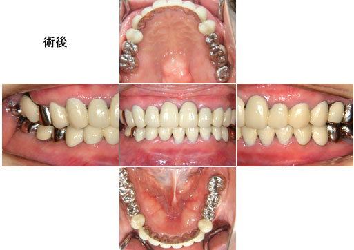 歯茎の色が悪い