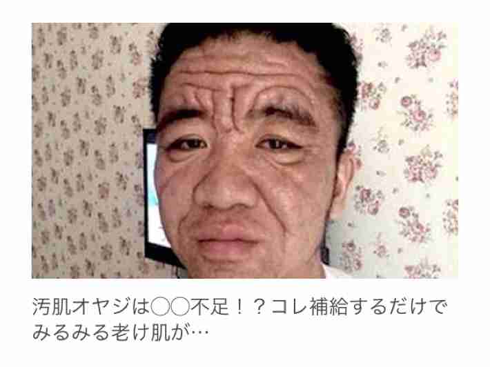 下の毛穴の皮脂詰まり。すごい臭いです ...