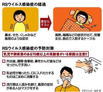 RSウイルス感染、1週間で1万人超…過去最多