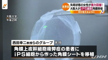 痛いニュース(ﾉ∀`) : 失明状態の女性が視力回復　大阪大がiPS細胞角膜移植 - ライブドアブログ