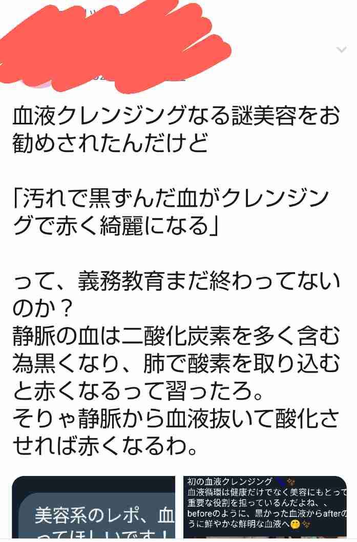 「血液クレンジング」効果ある?SNSで医師らが指摘 高橋みなみ、ISSAら芸能人も治療を報告で物議