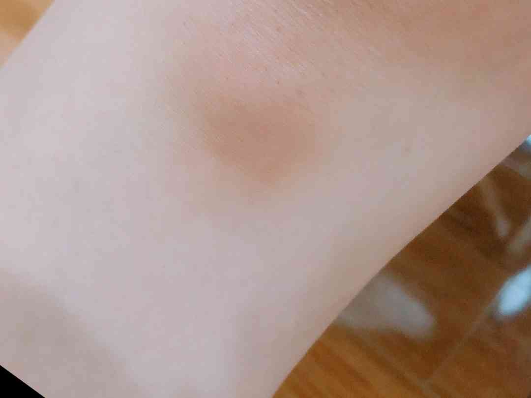 渡辺美奈代、雨中の外出で転倒しけが「滑って、、、転んでしまった」