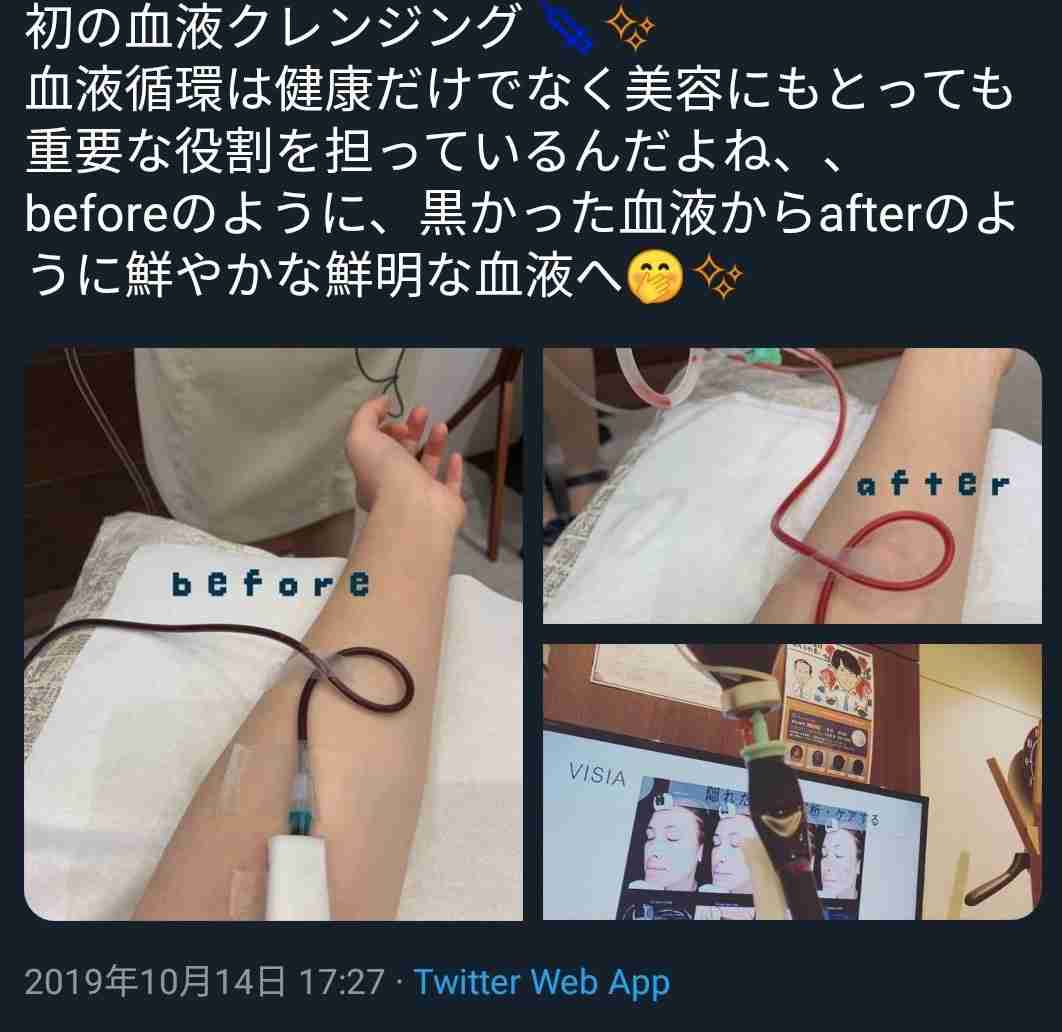 血液クレンジングに「HIV感染体験会の間違いだろ」の指摘…消費者はカモにされる？ネット上の反応まとめ | ENDIA