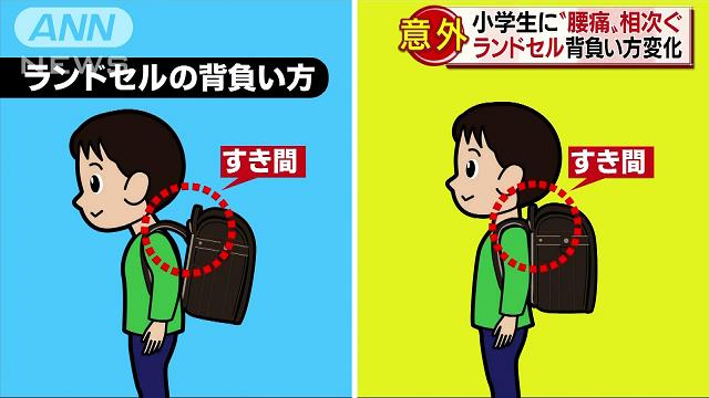 小学生に“腰痛”相次ぐ　原因の一つはランドセル