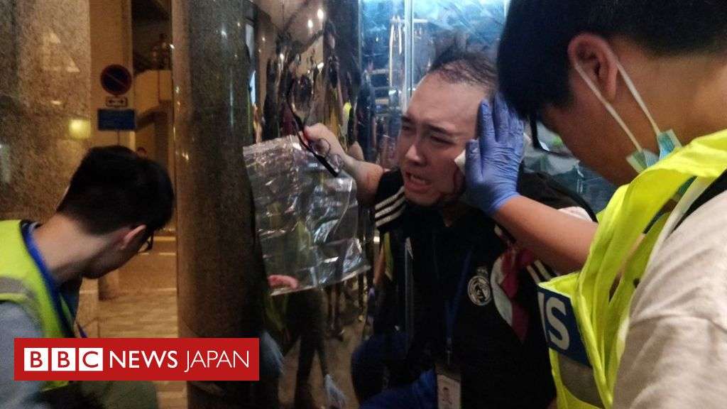 香港デモ、ナイフ男が5人襲撃　区議は耳を噛みちぎられる - BBCニュース