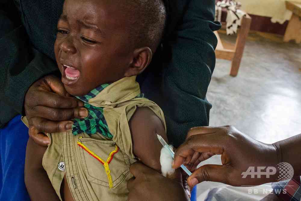 はしか感染で免疫システム「リセット」、米研究で明らかに　写真1枚　国際ニュース：AFPBB News