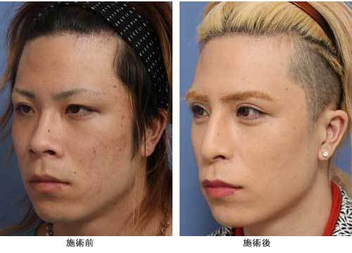 サンシャイン池崎が激変、“ホスト風”に絶賛