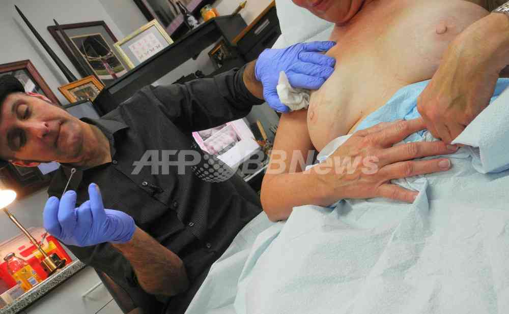 乳がん手術患者に新たな人生を、リアルな胸を再生する米タトゥーアーティスト　写真6枚　国際ニュース：AFPBB News