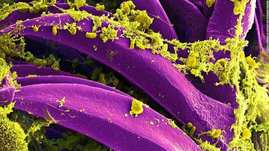 中国でまた腺ペストの感染者、２８人隔離　野ウサギが原因か（CNN.co.jp） - Yahoo!ニュース