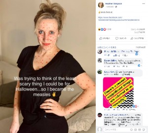 ハロウィンで麻疹患者になりきった女性「死亡率は0％に近い」と主張し大炎上（米）