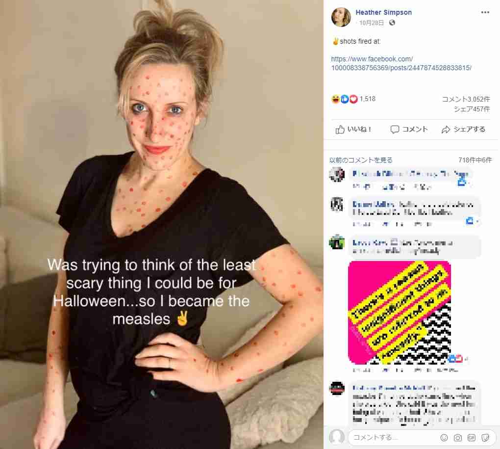 【海外発！Breaking News】ハロウィンで麻疹患者になりきった女性「死亡率は0％に近い」と主張し大炎上（米） | Techinsight（テックインサイト）|海外セレブ、国内エンタメのオンリーワンをお届けするニュースサイト