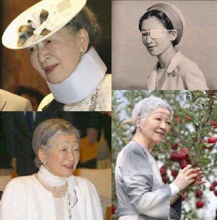 上皇后さま、血混じる嘔吐も　ストレス原因か、経過観察　宮内庁