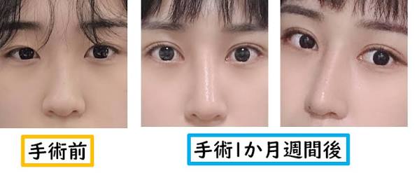 【色気】目の横幅が狭い【なし】