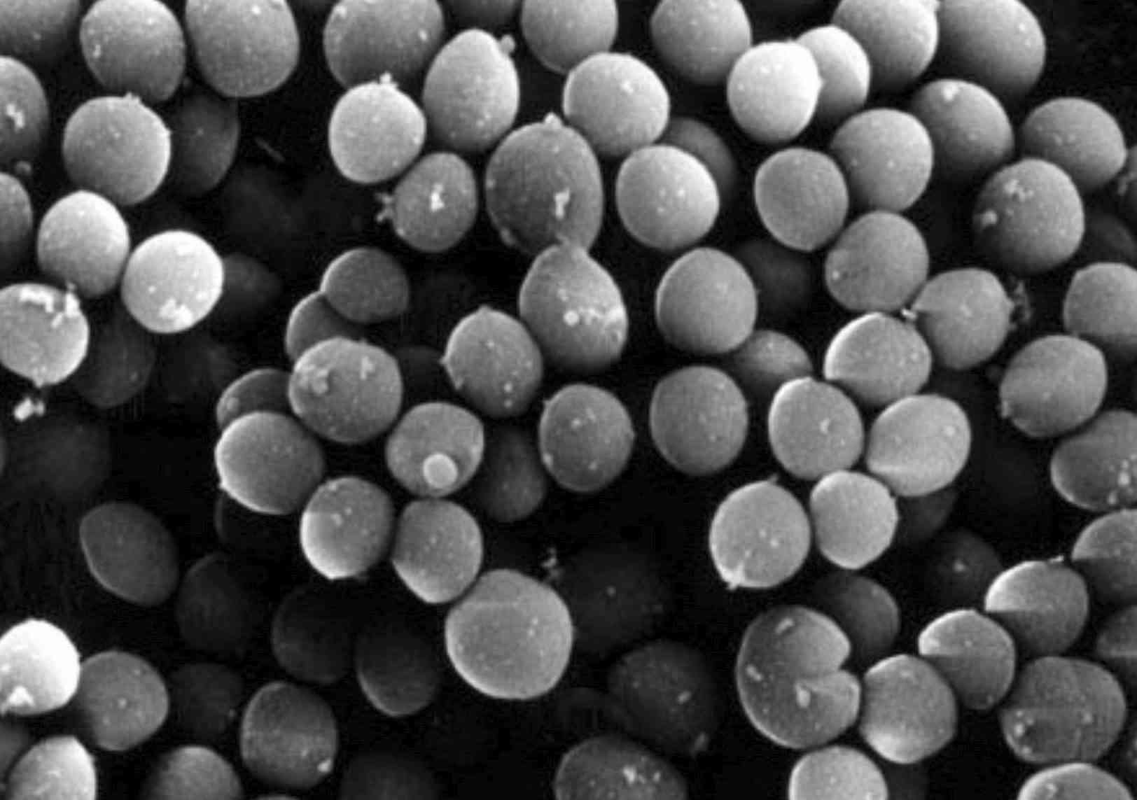 薬剤耐性菌2017年8千人死亡　国内初推計、影響深刻（共同通信） - Yahoo!ニュース