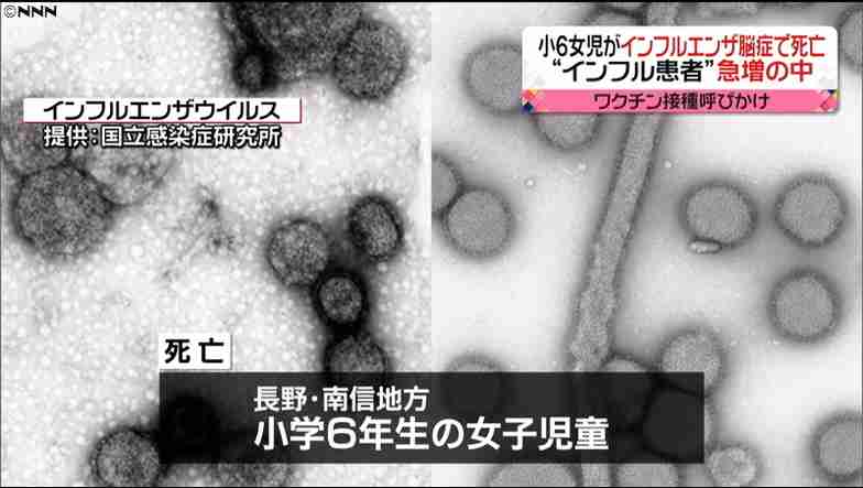 小6女児がインフルエンザ脳症で死亡　長野