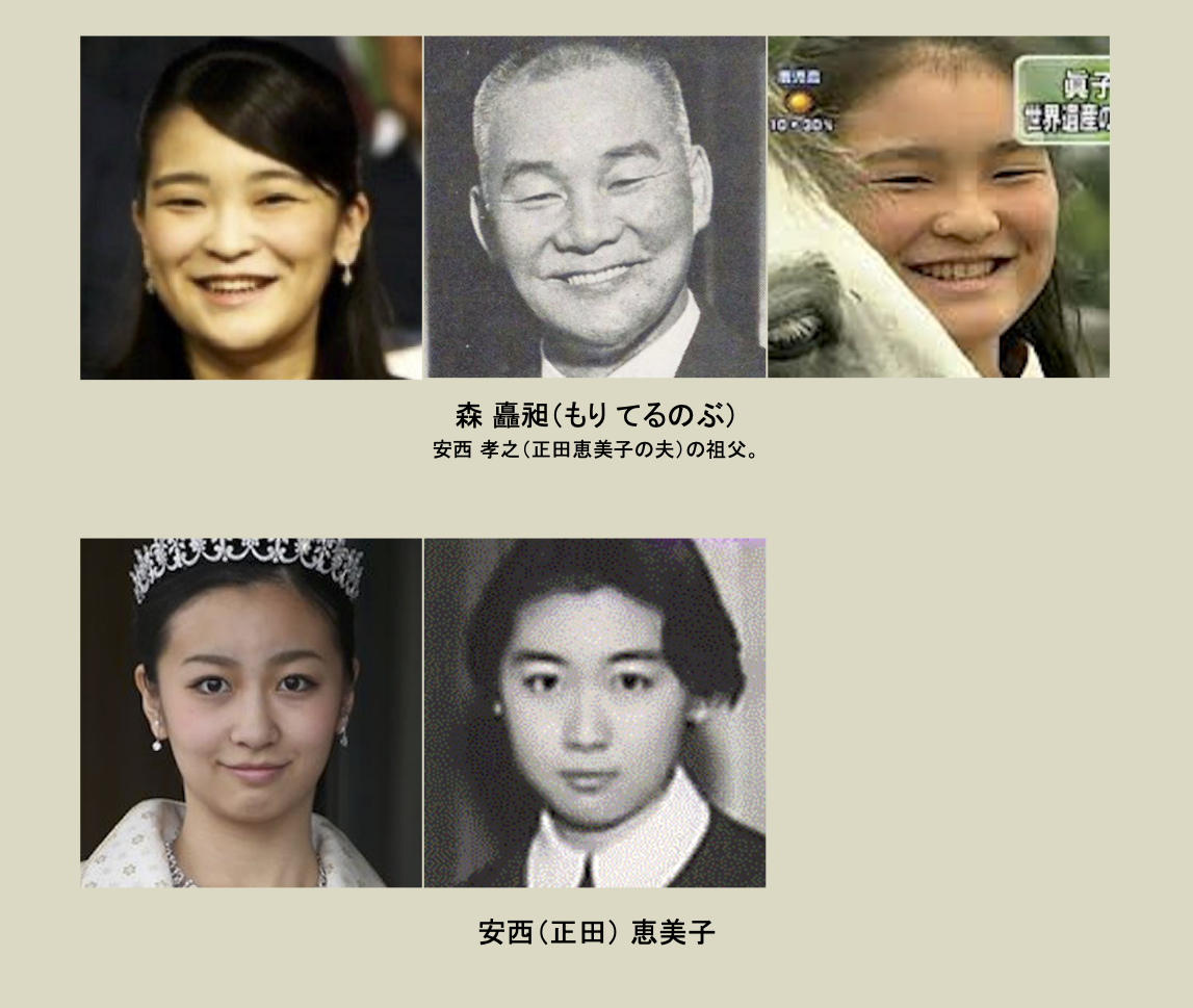 上皇后さま、血混じる嘔吐も ストレス原因か、経過観察 宮内庁