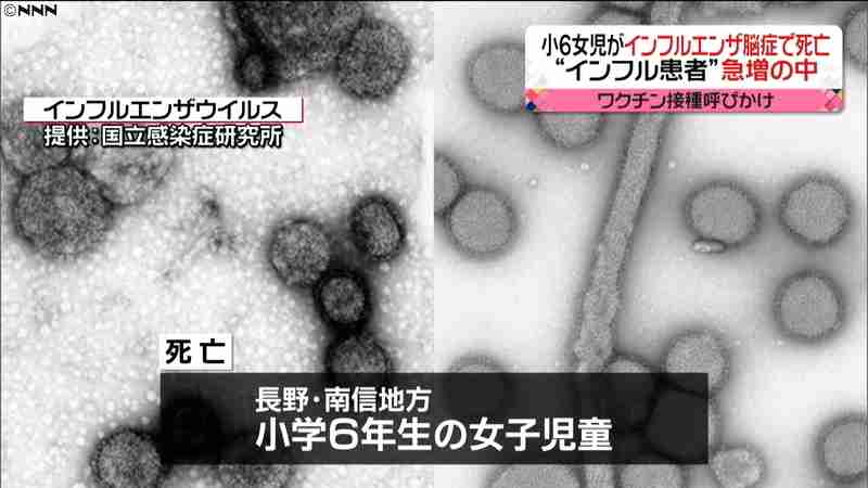 小６女児がインフルエンザ脳症で死亡　長野（日本テレビ系（NNN）） - Yahoo!ニュース