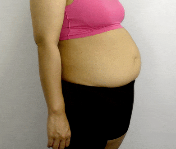 痩せたいデブの為に現実を突きつけるトピpart2