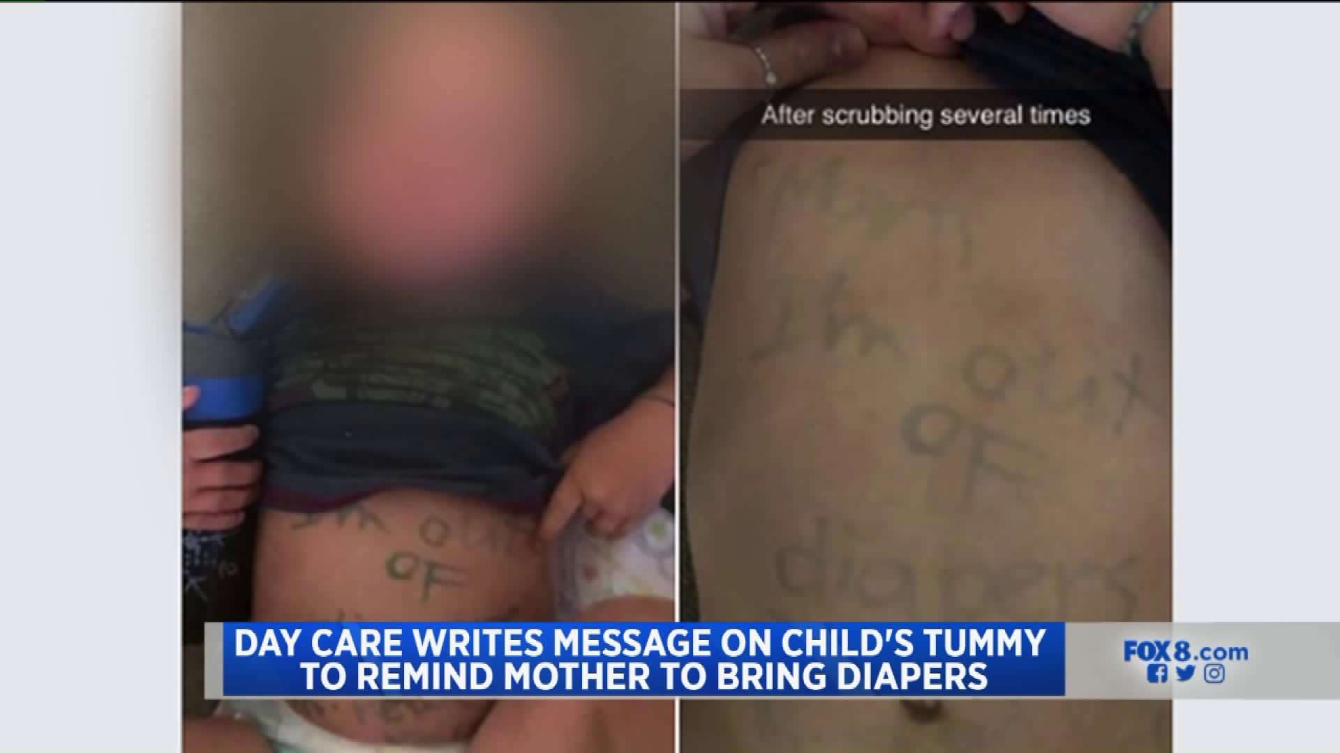 「おむつが足りない」、１歳男児の体にマジックで文字　米保育士解雇