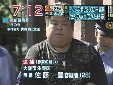 「親知らずを4本抜いた時の俺」　ヤバすぎる腫れ方に30万人の腹筋が崩壊