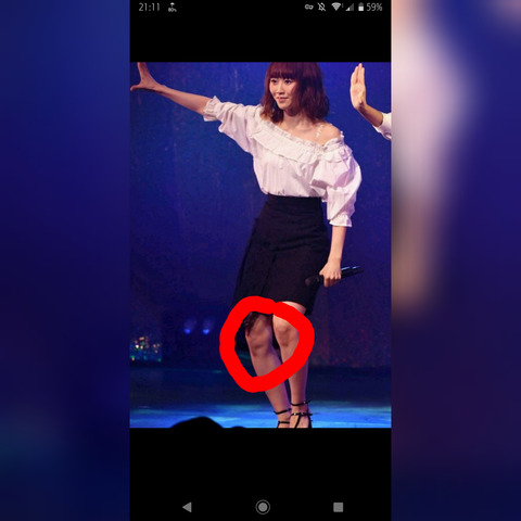 【NGT48】西潟茉莉奈の膝に人面瘡・・・ : AKB48まとめ 48年戦争