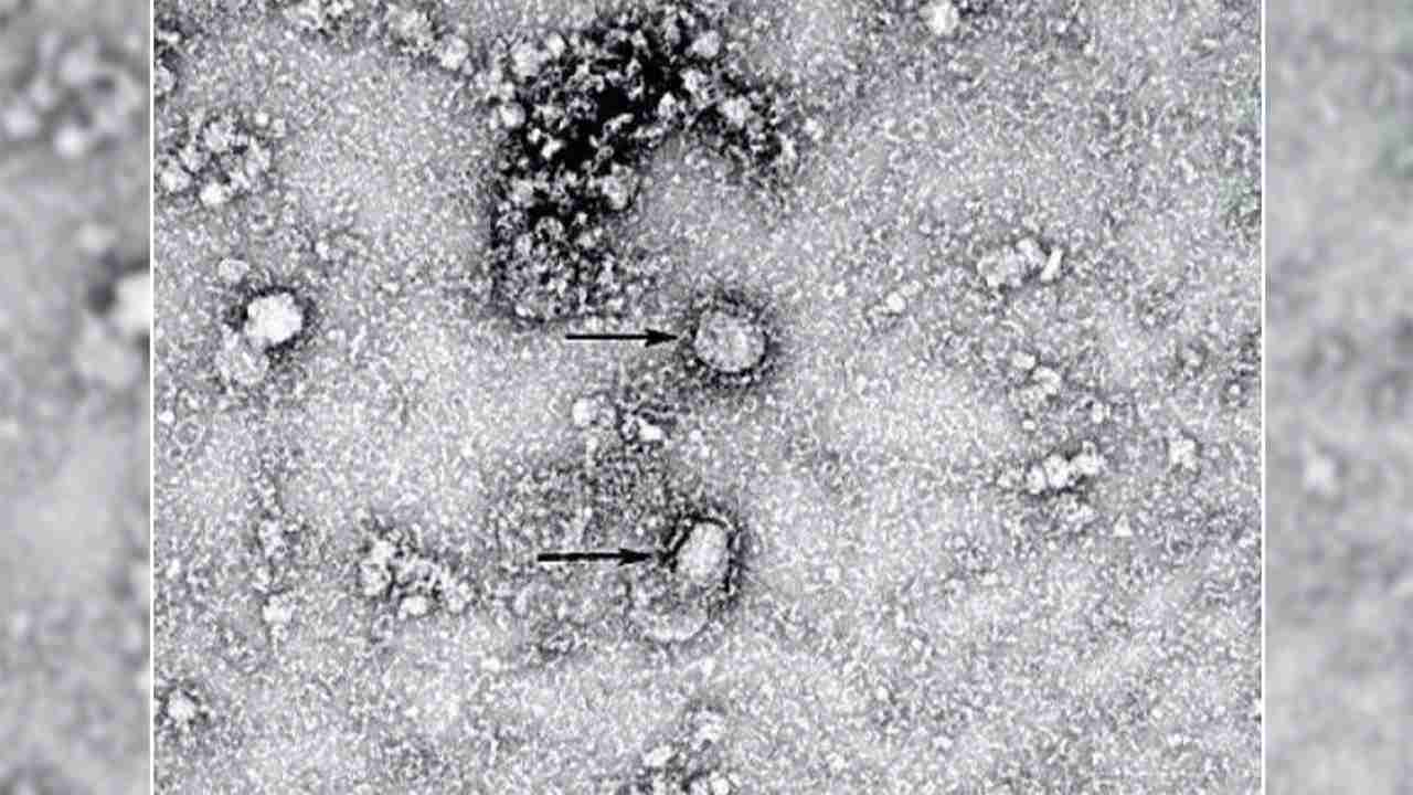 国内での感染者163人に　症状重い人も数人存在（フジテレビ系（FNN）） - Yahoo!ニュース