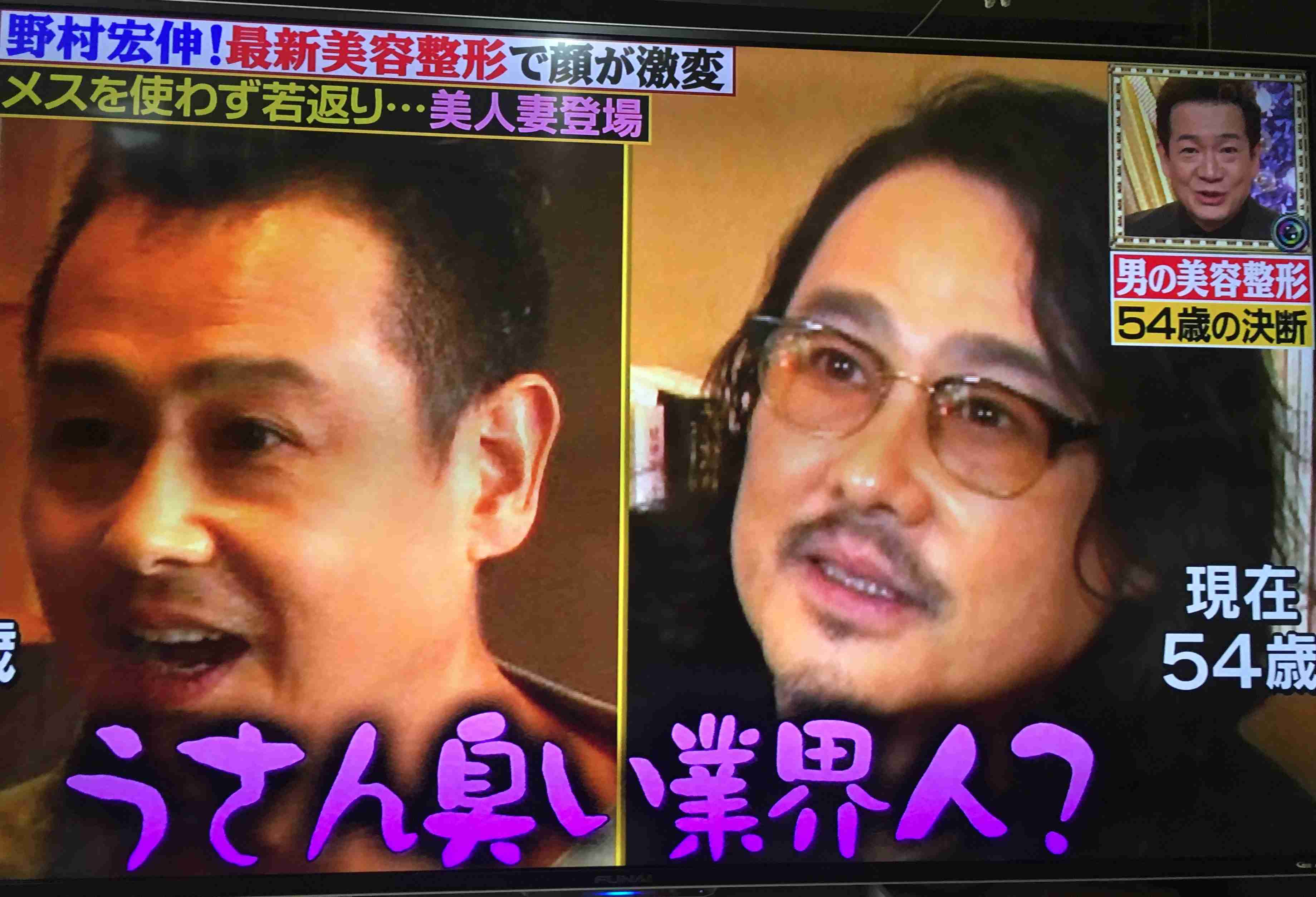 正直顔が変わりすぎだと思う男性芸能人