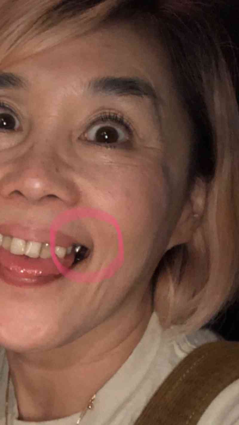 野沢直子 歯が抜けるも米国医療費高額過ぎて…「歯抜けばばあのまま貫く」
