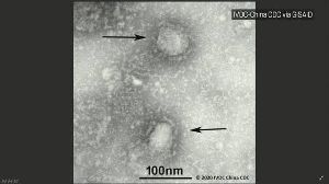 【速報】新型肺炎で香港初の死者を確認。香港メディア発表 ｜ 保守速報