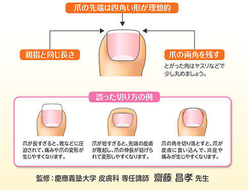 「お腹の肉が邪魔して…」　足の爪をほとんど切らない人の言い分とは