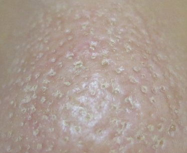 【助けて！！！】ファンデの毛穴落ち