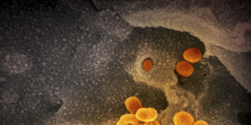 新型コロナ、保険適用検査進まず　413件、全体の3％ ｜ 共同通信