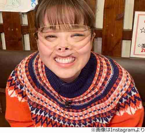 鈴木奈々、久々“顔面輪ゴム”に「ヤバい」の声