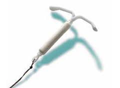 IUD（子宮内避妊具）を使用している方