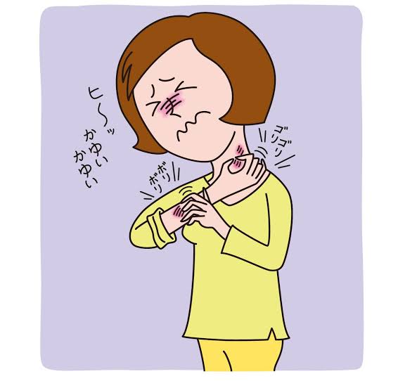 アレルギー性蕁麻疹の人