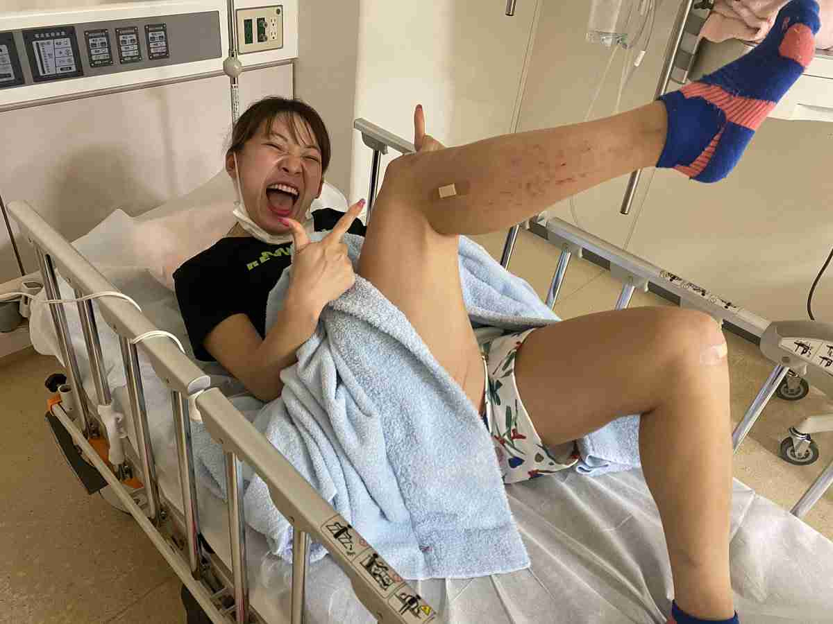 フワちゃん、交通事故に遭う「くるまはねられた」現状も報告