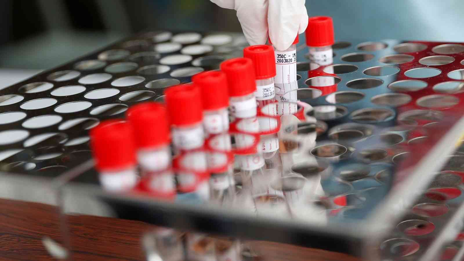 ｢PCR検査せよ｣と叫ぶ人に知って欲しい問題 | コロナ戦争を読み解く | 東洋経済オンライン | 経済ニュースの新基準