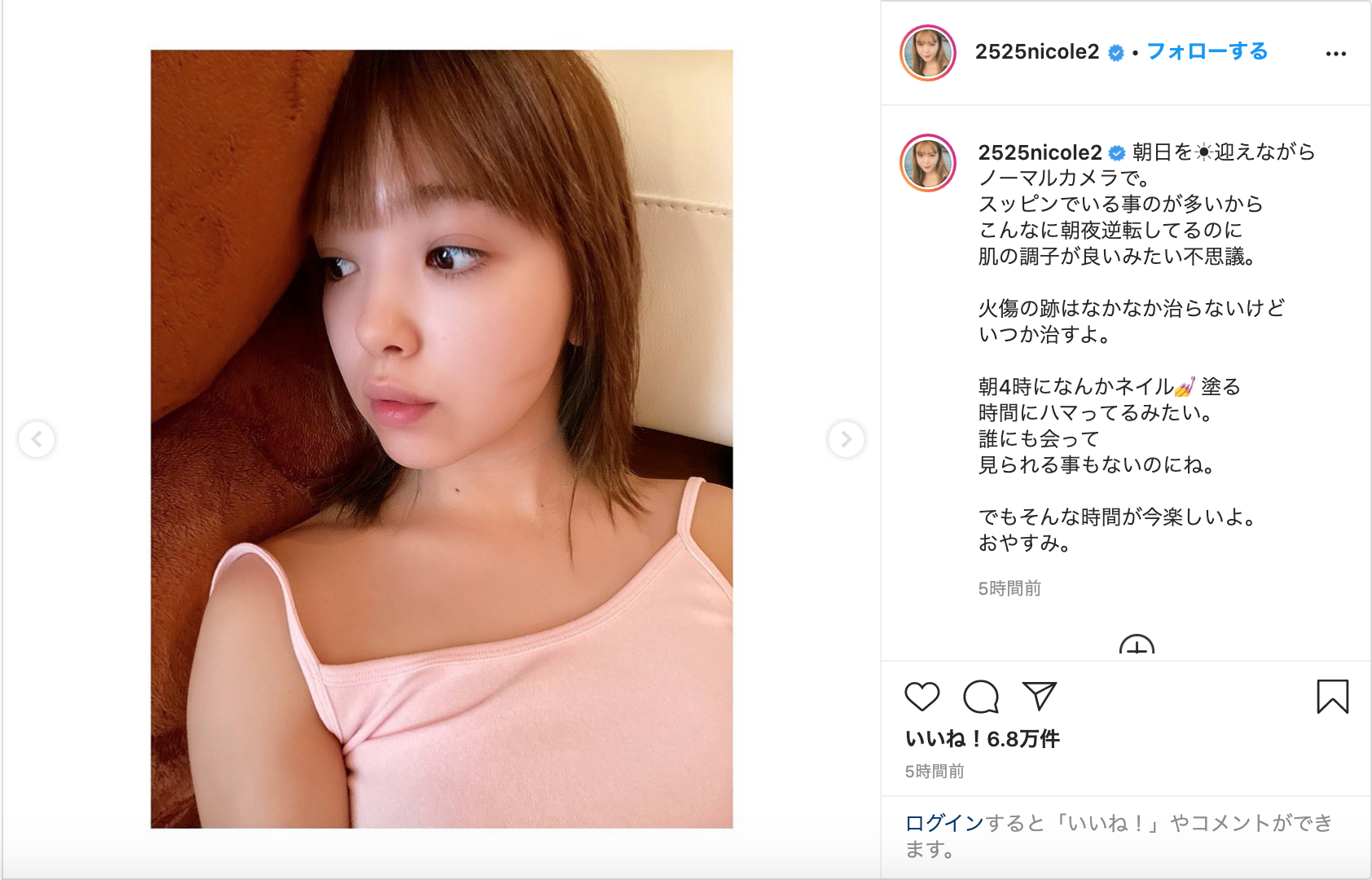 藤田ニコル、1カ月前の顔の火傷「なかなか治らない」5センチ以上の火傷跡にファンも心配