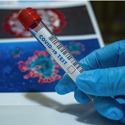 唾液PCR検査が可能に、有症状者を対象：日経メディカル