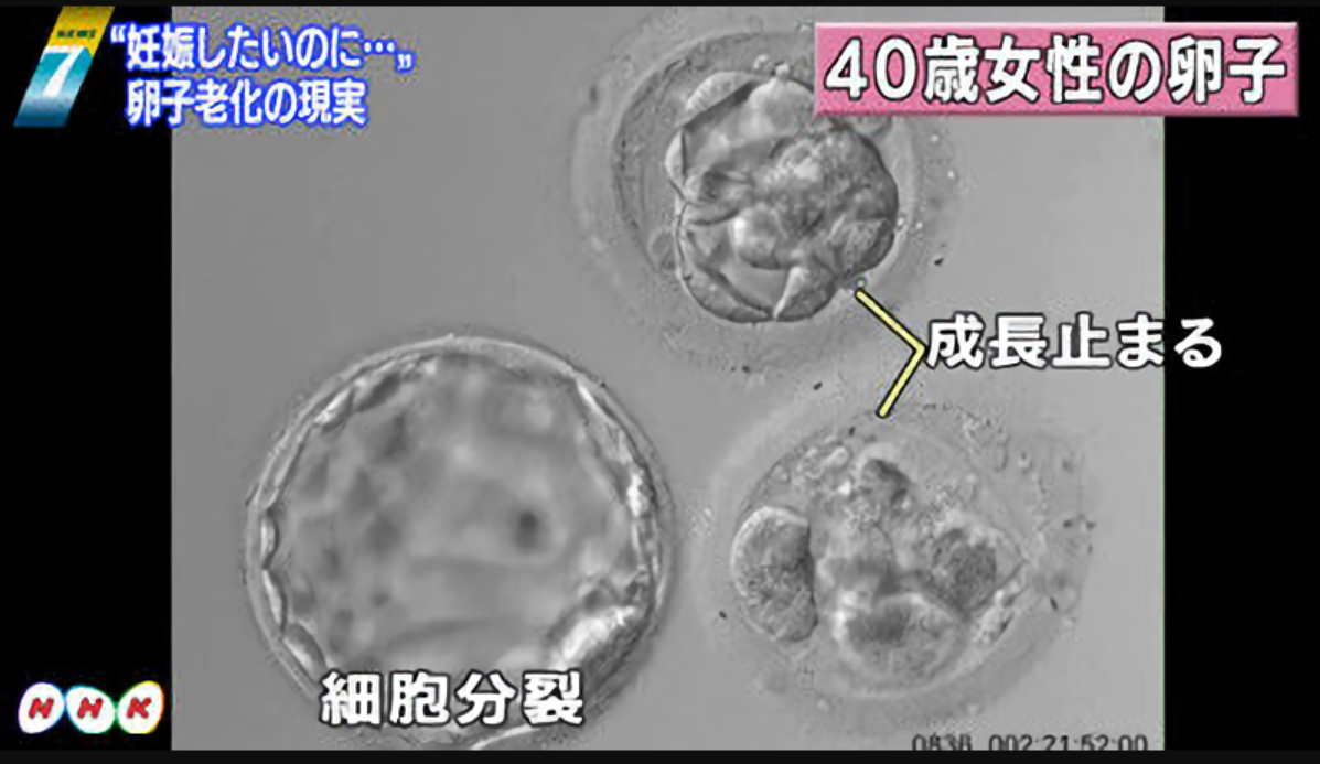 不妊治療の保険適用拡大　フリー保護へ指針策定　全世代社保　第2次中間報告